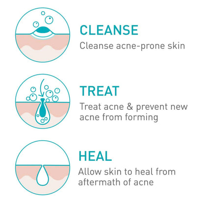 Acne Foaming Cream Cleanser