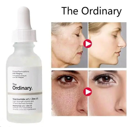 Ordinary Niacinamide Serum BUY 1 GET 1 FREE