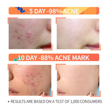 Ordinary Niacinamide Serum BUY 1 GET 1 FREE